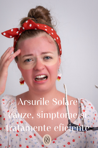 Arsurile Solare: cauze, simptome și tratamente eficiente 129 Arsurile solare cauze si tratamente eficiente uai