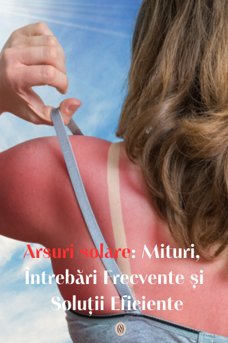 Arsuri solare: Mituri, Întrebări Frecvente și Soluții Eficiente 119 Arsuri solare Mituri Intrebari Frecvente si Solutii uai