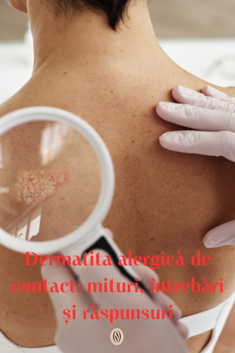 Dermatita alergică de contact: mituri, întrebări și răspunsuri 93 Dermatita alergica de contact intrebari si raspunsuri uai