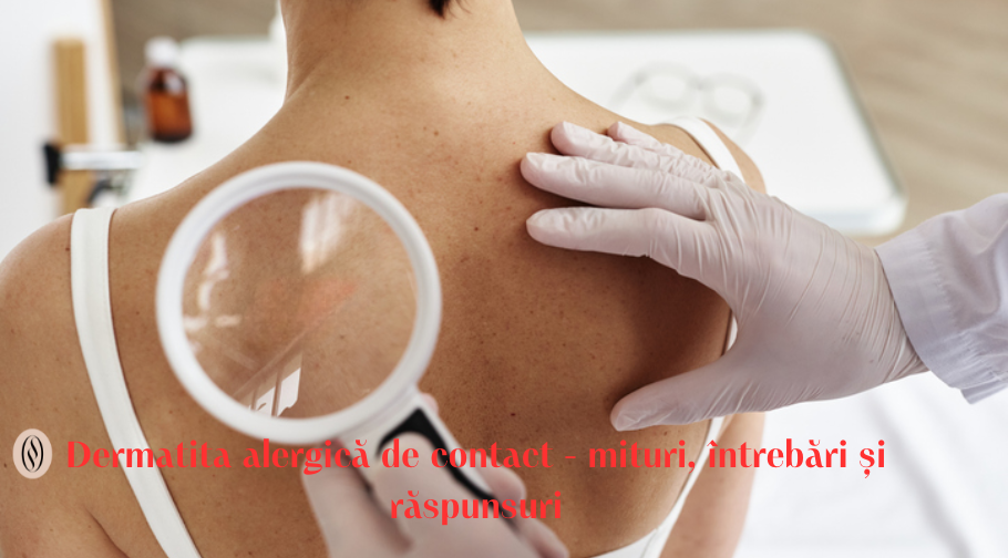 Dermatita alergică de contact: mituri, întrebări și răspunsuri 1 Dermatita alergica de contact mituri intrebari si raspunsuri 1
