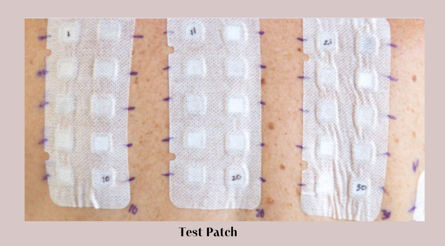 Dermatita alergică de contact: mituri, întrebări și răspunsuri 4 Test patch