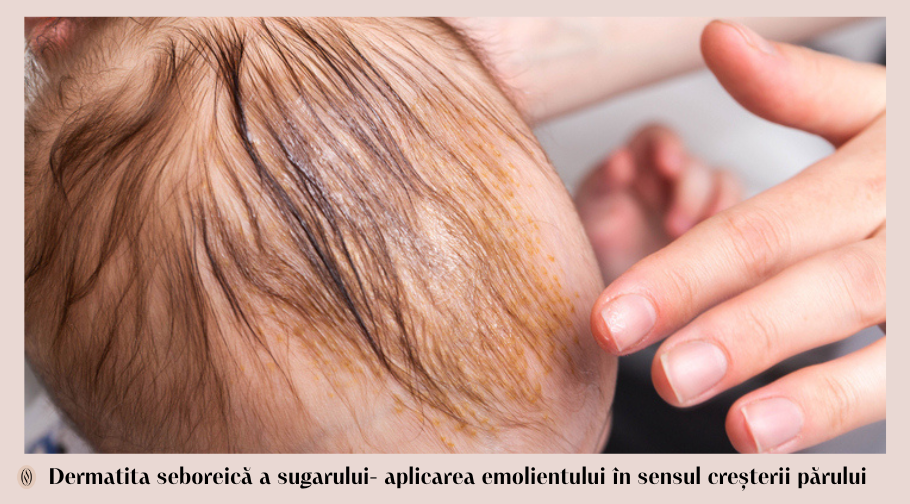 aplicarea emolientului pe crustele de lapte