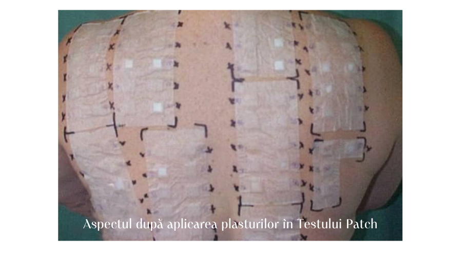 plasturii aplicati in testul patch
