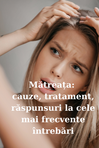 Mătreața: cauze, tratament, răspunsuri la cele mai frecvente întrebări 107 Matreata cauze tratament intrebari uai