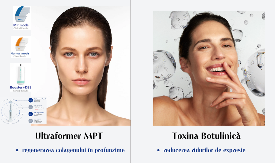 Ultraformer MPT si toxina botulinica