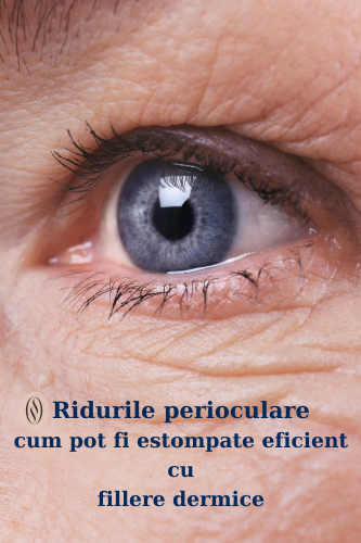Ridurile perioculare: Estompare eficientă cu fillere dermice 60 Ridurile perioculare: Estompare eficientă cu fillere dermice