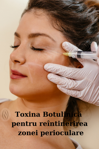Toxina Botulinică pentru reîntinerirea zonei perioculare 58 Toxina Botulinică pentru reîntinerirea zonei perioculare