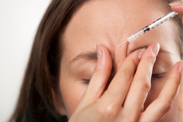 Fillere cu acid hialuronic – umplerea ridurilor statice