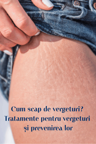 Cum scap de vergeturi? Tratamente pentru vergeturi și prevenirea lor 34 Cum scap de vergeturi Tratamente pentru vergeturi și prevenirea lor