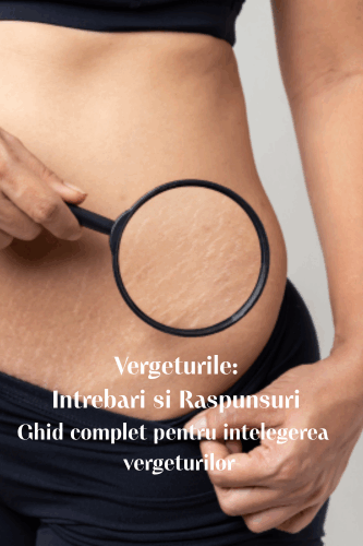 Vergeturile: Intrebari si Raspunsuri | Ghid complet pentru intelegerea si tratarea vergeturilor 33 vergeturile tratamente vergeturi