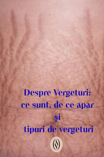 Despre Vergeturi: ce sunt, de ce apar și tipuri de vergeturi 35 Despre Vergeturi ce sunt, de ce apar și tipuri de vergeturi