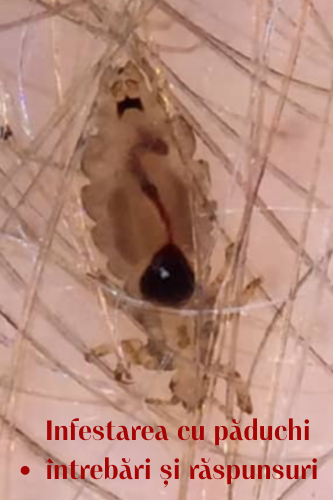 Pediculoza (infestarea cu păduchi) : 30 Intrebari si Raspunsuri Esentiale 43 Pediculoza infestarea cu paduchi