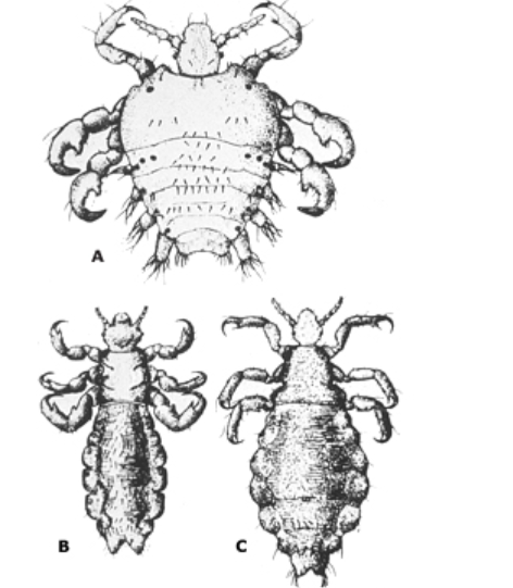 Infestarea cu păduchi (Pediculoza) 2 tipuri-de-paduchi