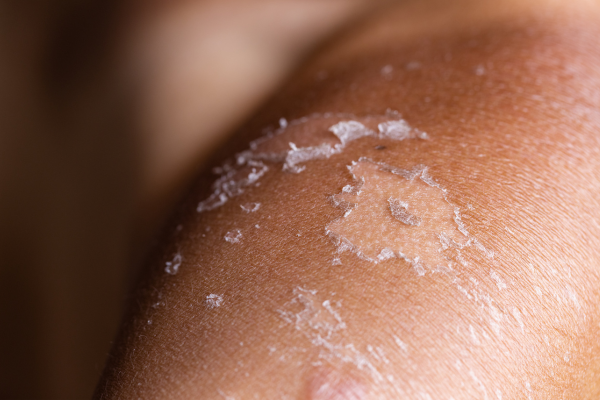 Mit sau Adevăr: Crema SPF 50+ provoacă cancer? 2 crema SPF 50+ provoaca cancer