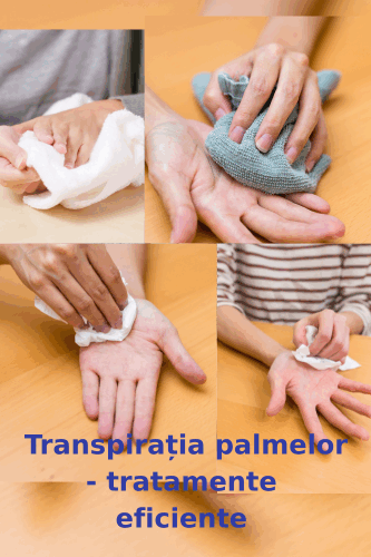 Transpirația palmelor: tratamente care funcționează 23 Tratamentele pentru transpiratia palmelor