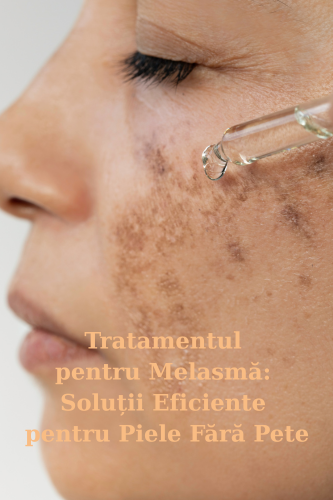 Tratamentul pentru Melasmă: Soluții Eficiente pentru Piele Fără Pete (partea 2) 9 tratamentul pentru melasma