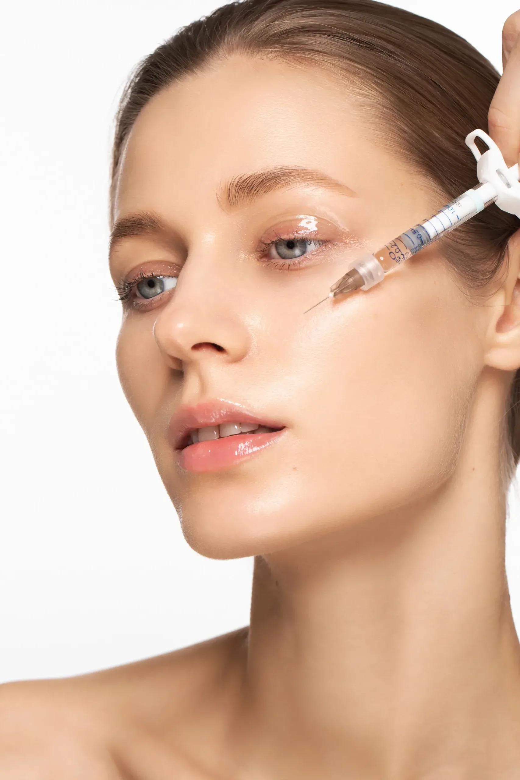 Corecție și Volumetrie facială cu acid hialuronic (cearcăne, pomeți, bărbie, linie mandibulară)