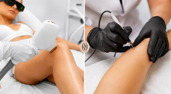 Epilare cu Laser sau Electroepilare ? 1 epilare laser electroepilare