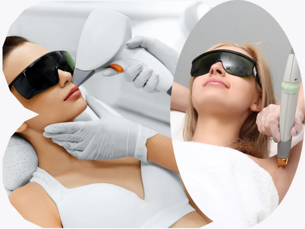 De ce epilarea cu laser nu dă rezultate? Cauze posibile si solutii 3 epilarea laser